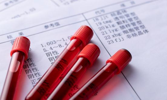 血液制品產(chǎn)業(yè)前景展望 未來行業(yè)的集中度會進(jìn)一步提高